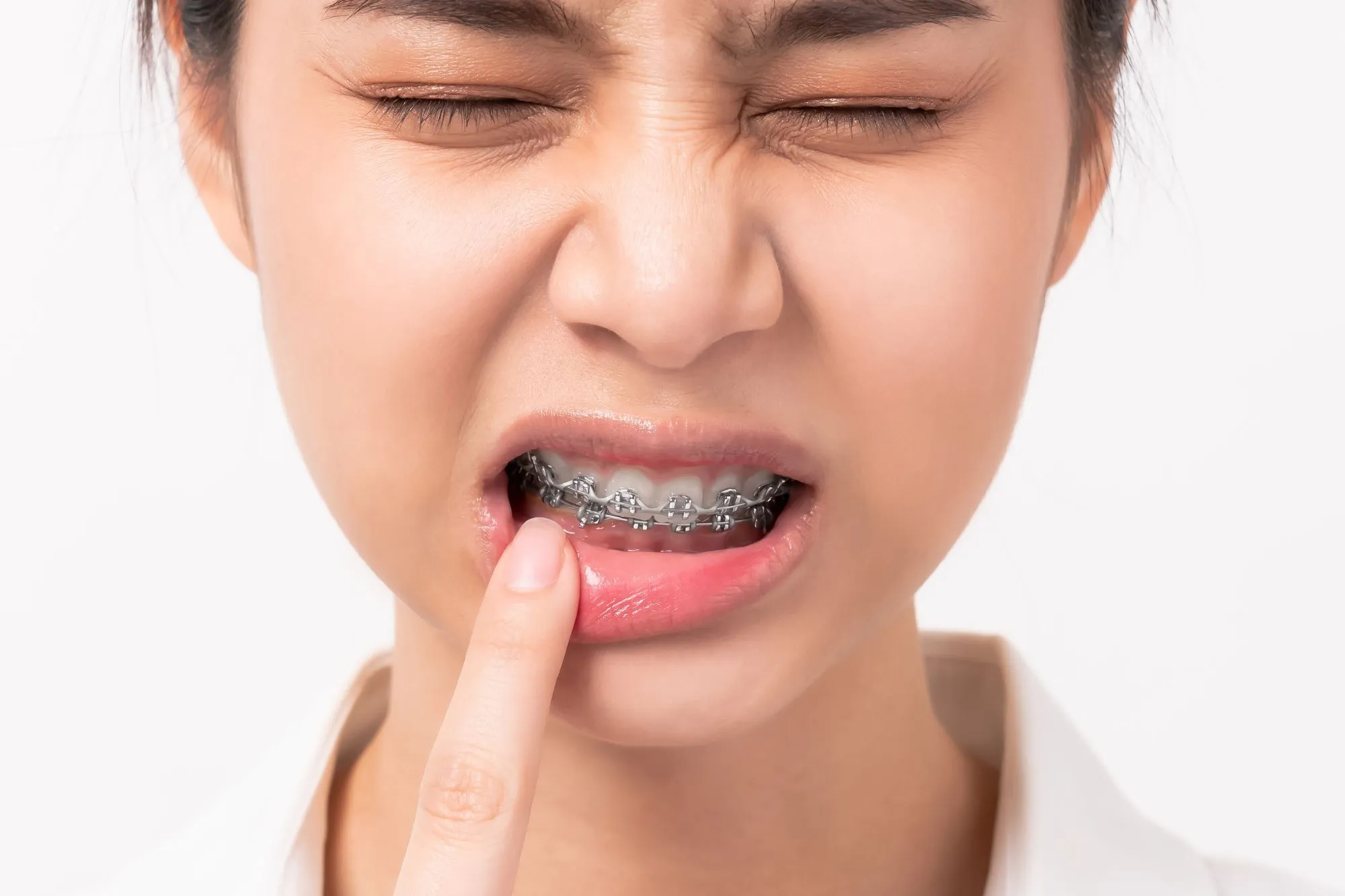 Balancing Forces: Innovations in Orthodontic Pain Relief