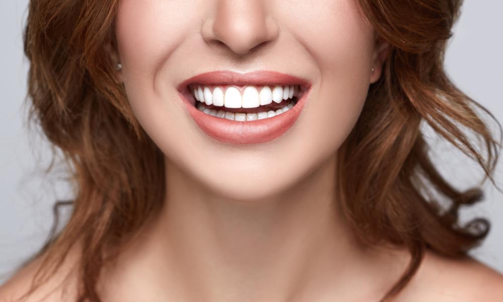 Implant dentaire abordable : comprendre le prix, le devis et le remboursement sans mauvaises surprises