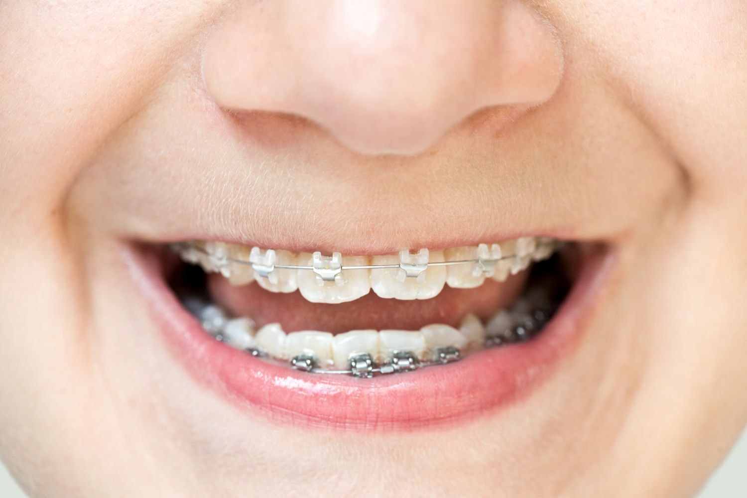 Optimizing Sliding Mechanics: A Journey Through Friction and Efficiency