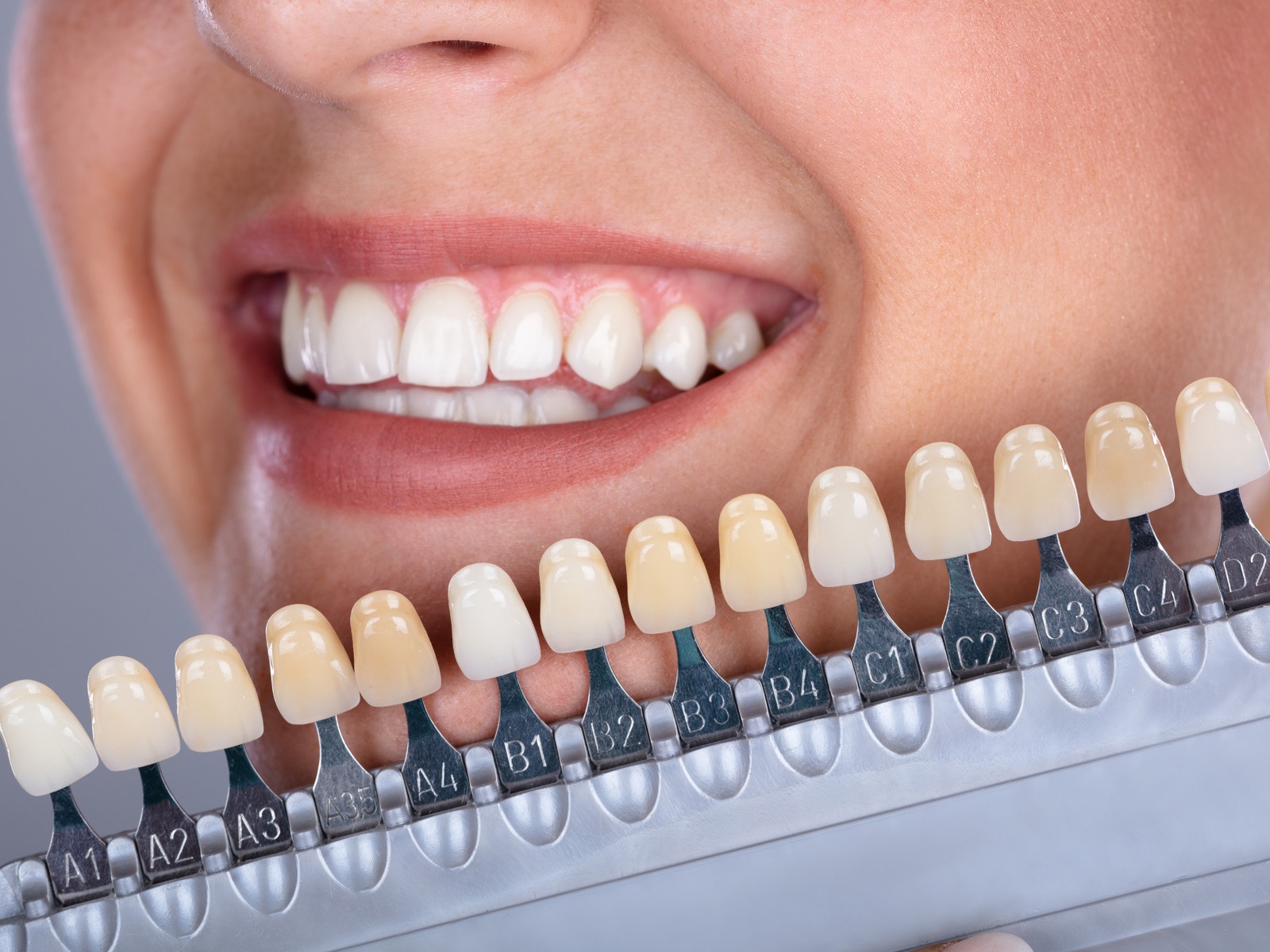 Designing Smiles: The Art and Science of Aesthetic Dentures
